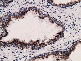 ERGIC-53 / LMAN1 Antibody - IHC of paraffin-embedded Human prostate tissue using anti-LMAN1 mouse monoclonal antibody. (Heat-induced epitope retrieval by 10mM citric buffer, pH6.0, 100C for 10min).
