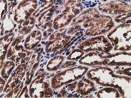 ERGIC-53 / LMAN1 Antibody - IHC of paraffin-embedded Human Kidney tissue using anti-LMAN1 mouse monoclonal antibody. (Heat-induced epitope retrieval by 10mM citric buffer, pH6.0, 100C for 10min).