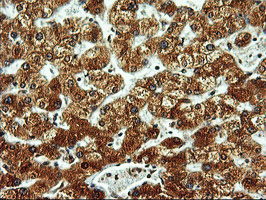 ERGIC-53 / LMAN1 Antibody - IHC of paraffin-embedded Human liver tissue using anti-LMAN1 mouse monoclonal antibody. (Heat-induced epitope retrieval by 10mM citric buffer, pH6.0, 100C for 10min).