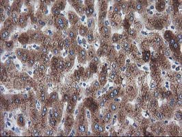 ERGIC-53 / LMAN1 Antibody - IHC of paraffin-embedded Human liver tissue using anti-LMAN1 mouse monoclonal antibody. (Heat-induced epitope retrieval by 10mM citric buffer, pH6.0, 100C for 10min).