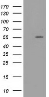 ERGIC-53 / LMAN1 Antibody - HEK293T cells were transfected with the pCMV6-ENTRY control (Left lane) or pCMV6-ENTRY LMAN1 (Right lane) cDNA for 48 hrs and lysed. Equivalent amounts of cell lysates (5 ug per lane) were separated by SDS-PAGE and immunoblotted with anti-LMAN1.
