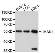 ERGIC-53 / LMAN1 Antibody - Western blot analysis of extracts of various cell lines, using LMAN1 antibody at 1:1000 dilution. The secondary antibody used was an HRP Goat Anti-Rabbit IgG (H+L) at 1:10000 dilution. Lysates were loaded 25ug per lane and 3% nonfat dry milk in TBST was used for blocking. An ECL Kit was used for detection and the exposure time was 5s.