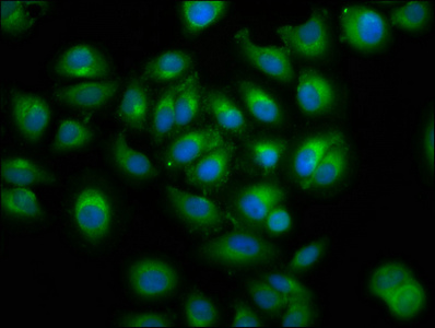 ERGIC-53 / LMAN1 Antibody - Immunofluorescence staining of A549 cells at a dilution of 1:100, counter-stained with DAPI. The cells were fixed in 4% formaldehyde, permeabilized using 0.2% Triton X-100 and blocked in 10% normal Goat Serum. The cells were then incubated with the antibody overnight at 4 °C.The secondary antibody was Alexa Fluor 488-congugated AffiniPure Goat Anti-Rabbit IgG (H+L) .