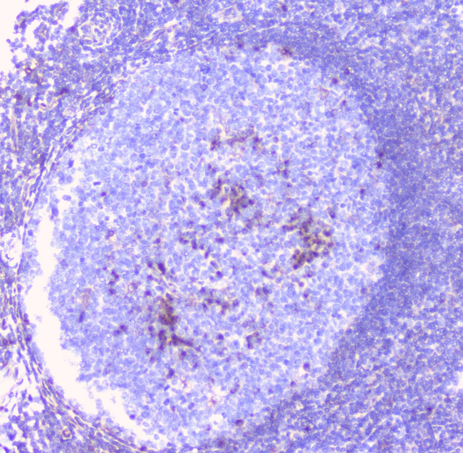 ERGIC-53 / LMAN1 Antibody - IHC analysis of LMAN1 using anti-LMAN1 antibody. LMAN1 was detected in paraffin-embedded section of human tonsil tissue. Heat mediated antigen retrieval was performed in citrate buffer (pH6, epitope retrieval solution) for 20 mins. The tissue section was blocked with 10% goat serum. The tissue section was then incubated with 1µg/ml rabbit anti-LMAN1 Antibody overnight at 4°C. Biotinylated goat anti-rabbit IgG was used as secondary antibody and incubated for 30 minutes at 37°C. The tissue section was developed using Strepavidin-Biotin-Complex (SABC) with DAB as the chromogen.