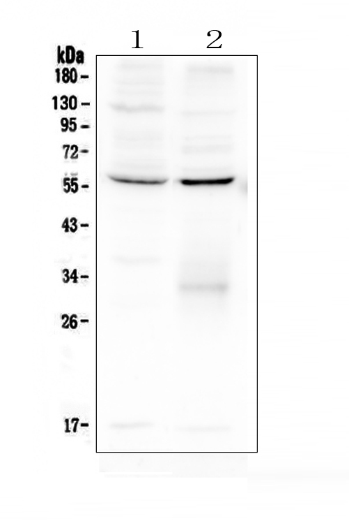 ERGIC-53 / LMAN1 Antibody - Western blot analysis of LMAN1 using anti-LMAN1 antibody. Electrophoresis was performed on a 5-20% SDS-PAGE gel at 70V (Stacking gel) / 90V (Resolving gel) for 2-3 hours. The sample well of each lane was loaded with 50ug of sample under reducing conditions. Lane 1: human HL-60 whole cell lysate,Lane 2: human A431 whole cell lysate. After Electrophoresis, proteins were transferred to a Nitrocellulose membrane at 150mA for 50-90 minutes. Blocked the membrane with 5% Non-fat Milk/ TBS for 1.5 hour at RT. The membrane was incubated with rabbit anti-LMAN1 antigen affinity purified polyclonal antibody at 0.5 µg/mL overnight at 4°C, then washed with TBS-0.1% Tween 3 times with 5 minutes each and probed with a goat anti-rabbit IgG-HRP secondary antibody at a dilution of 1:10000 for 1.5 hour at RT. The signal is developed using an Enhanced Chemiluminescent detection (ECL) kit with Tanon 5200 system. A specific band was detected for LMAN1 at approximately 58KD. The expected band size for LMAN1 is at 58KD.