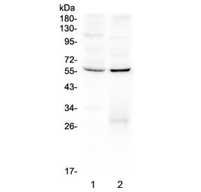 ERGIC-53 / LMAN1 Antibody - Western blot testing of human 1) HeLa and 2) A431 lysate with LMAN1 antibody at 0.5ug/ml. Predicted molecular weight ~53 kDa.