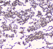 ERGIC-53 / LMAN1 Antibody - IHC staining of FFPE human glioma with LMAN1 antibody at 1ug/ml. HIER: boil tissue sections in pH6, 10mM citrate buffer, for 10-20 min followed by cooling at RT for 20 min.