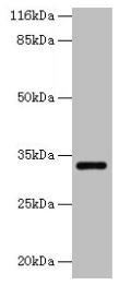 ERGIC1 Antibody - Western blot All lanes: ERGIC1 antibody at 2µg/ml + HepG2 whole cell lysate Secondary Goat polyclonal to rabbit IgG at 1/10000 dilution Predicted band size: 33, 23, 18 kDa Observed band size: 33 kDa