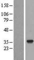 ERGIC1 Protein - Western validation with an anti-DDK antibody * L: Control HEK293 lysate R: Over-expression lysate