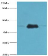 ERGIC2 Antibody - Western blot. All lanes: Endoplasmic reticulum-Golgi intermediate compartment protein 2 antibody at 4 ug/ml. Lane 1: HepG2 whole cell lysate. Lane 2: Jurkat whole cell lysate. Lane 3: mouse lung tissue. secondary Goat polyclonal to rabbit at 1:10000 dilution. Predicted band size: 43 kDa. Observed band size: 43 kDa.
