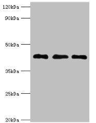 ERGIC2 Antibody - Western blot All lanes: Endoplasmic reticulum-Golgi intermediate compartment protein 2 antibody at 4µg/ml Lane 1: HepG2 whole cell lysate Lane 2: Jurkat whole cell lysate Lane 3: Mouse lung tissue Secondary Goat polyclonal to rabbit IgG at 1/10000 dilution Predicted band size: 43 kDa Observed band size: 43 kDa