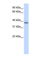 ERGIC2 Antibody - ERGIC2 antibody Western blot of Jurkat lysate. This image was taken for the unconjugated form of this product. Other forms have not been tested.