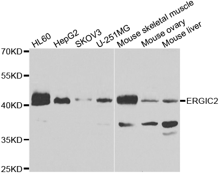 ERGIC2 Antibody - Western blot analysis of extracts of various cell lines.