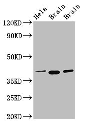 ERGIC2 Antibody - Positive Western Blot detected in Hela whole cell lysate, Rat brain tissue, Mouse brain tissue. All lanes: ERGIC2 antibody at 2.5 µg/ml Secondary Goat polyclonal to rabbit IgG at 1/50000 dilution. Predicted band size: 43 KDa. Observed band size: 43 KDa