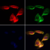 ERGIC2 Antibody - Staining HeLa cells by IF/ICC. The samples were fixed with PFA and permeabilized in 0.1% Triton X-100, then blocked in 10% serum for 45 min at 25°C. Samples were then incubated with primary Ab(1:200) and mouse anti-beta tubulin Ab(1:200) for 1 hour at 37°C. An AlexaFluor594 conjugated goat anti-rabbit IgG(H+L) Ab(1:200 Red) and an AlexaFluor488 conjugated goat anti-mouse IgG(H+L) Ab(1:600 Green) were used as the secondary antibod