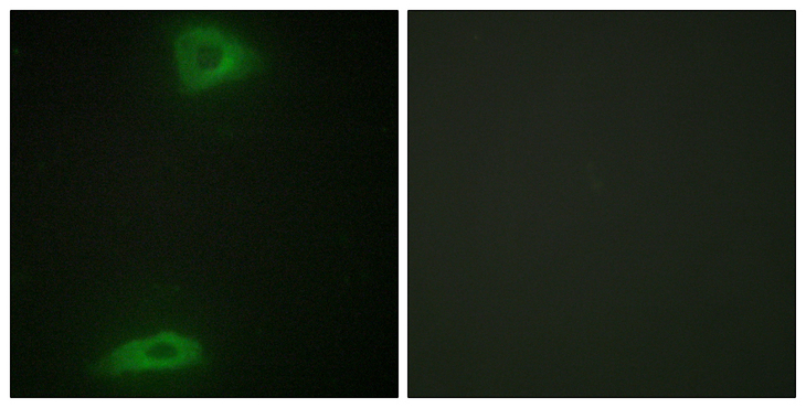 ERGIC3 Antibody - Immunofluorescence analysis of HepG2 cells, using ERGI3 Antibody. The picture on the right is blocked with the synthesized peptide.