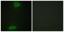 ERGIC3 Antibody - Immunofluorescence analysis of HepG2 cells, using ERGI3 Antibody. The picture on the right is blocked with the synthesized peptide.
