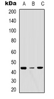 ERGIC3 Antibody - Western blot analysis of ERGIC3 expression in MCF7 (A); HeLa (B); NIH3T3 (C) whole cell lysates.