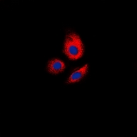 ERGIC3 Antibody - Immunofluorescent analysis of ERGIC3 staining in MCF7 cells. Formalin-fixed cells were permeabilized with 0.1% Triton X-100 in TBS for 5-10 minutes and blocked with 3% BSA-PBS for 30 minutes at room temperature. Cells were probed with the primary antibody in 3% BSA-PBS and incubated overnight at 4 deg C in a humidified chamber. Cells were washed with PBST and incubated with a DyLight 594-conjugated secondary antibody (red) in PBS at room temperature in the dark. DAPI was used to stain the cell nuclei (blue).