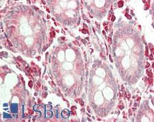 ERGIC3 Antibody - Human Colon: Formalin-Fixed, Paraffin-Embedded (FFPE).  This image was taken for the unconjugated form of this product. Other forms have not been tested.