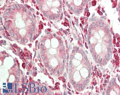 ERGIC3 Antibody - Human Colon: Formalin-Fixed, Paraffin-Embedded (FFPE).  This image was taken for the unconjugated form of this product. Other forms have not been tested.