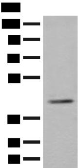 ERGIC3 Antibody - Western blot analysis of K562 cell lysate  using ERGIC3 Polyclonal Antibody at dilution of 1:400