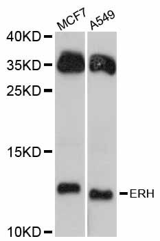 ERH Antibody - Western blot analysis of extracts of various cell lines, using ERH antibody at 1:3000 dilution. The secondary antibody used was an HRP Goat Anti-Rabbit IgG (H+L) at 1:10000 dilution. Lysates were loaded 25ug per lane and 3% nonfat dry milk in TBST was used for blocking. An ECL Kit was used for detection and the exposure time was 90s.