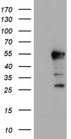 ERI1 / HEXO Antibody - HEK293T cells were transfected with the pCMV6-ENTRY control (Left lane) or pCMV6-ENTRY ERI1 (Right lane) cDNA for 48 hrs and lysed. Equivalent amounts of cell lysates (5 ug per lane) were separated by SDS-PAGE and immunoblotted with anti-ERI1.