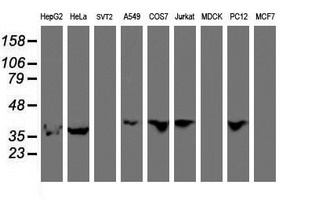 ERI1 / HEXO Antibody - Western blot of extracts (35 ug) from 9 different cell lines by using anti-ERI1 monoclonal antibody.