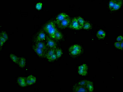 ERI1 / HEXO Antibody - Immunofluorescence staining of HepG2 cells at a dilution of 1:133, counter-stained with DAPI. The cells were fixed in 4% formaldehyde, permeabilized using 0.2% Triton X-100 and blocked in 10% normal Goat Serum. The cells were then incubated with the antibody overnight at 4°C.The secondary antibody was Alexa Fluor 488-congugated AffiniPure Goat Anti-Rabbit IgG (H+L) .