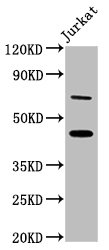 ERI1 / HEXO Antibody - Positive Western Blot detected in Jurkat whole cell lysate. All lanes: ERI1 antibody at 7 µg/ml Secondary Goat polyclonal to rabbit IgG at 1/50000 dilution. Predicted band size: 41 KDa. Observed band size: 46 KDa