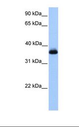 ERI2 / EXOD1 Antibody - Jurkat cell lysate. Antibody concentration: 1.0 ug/ml. Gel concentration: 12%.  This image was taken for the unconjugated form of this product. Other forms have not been tested.