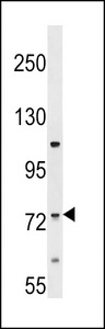 ERI2 / EXOD1 Antibody - ERI2 Antibody western blot of HL-60 cell line lysates (35 ug/lane). The ERI2 antibody detected the ERI2 protein (arrow).