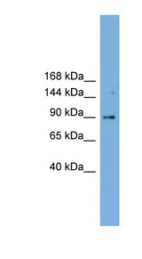 ERIC-1 / TACC3 Antibody - TACC3 antibody western blot of NCI-H226 cell lysate.  This image was taken for the unconjugated form of this product. Other forms have not been tested.