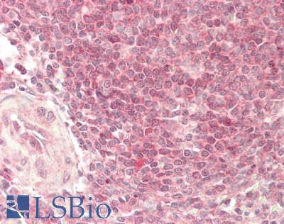 ERIC-1 / TACC3 Antibody - Human Spleen: Formalin-Fixed, Paraffin-Embedded (FFPE)