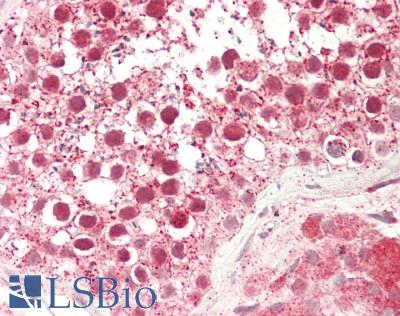 ERIC-1 / TACC3 Antibody - Human Testis: Formalin-Fixed, Paraffin-Embedded (FFPE)