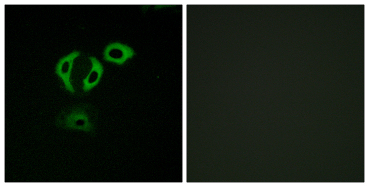 ERIC-1 / TACC3 Antibody - Immunofluorescence analysis of A549 cells, using TACC3 Antibody. The picture on the right is blocked with the synthesized peptide.