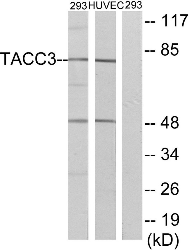ERIC-1 / TACC3 Antibody - Western blot analysis of lysates from 293 and HUVEC cells, using TACC3 Antibody. The lane on the right is blocked with the synthesized peptide.