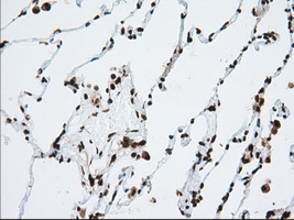 ERIC-1 / TACC3 Antibody - Immunohistochemical staining of paraffin-embedded Human lung tissue using anti-TACC3 mouse monoclonal antibody. (Dilution 1:50).