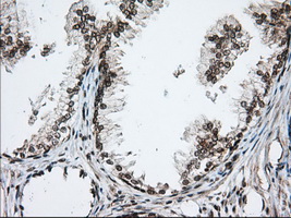 ERIC-1 / TACC3 Antibody - Immunohistochemical staining of paraffin-embedded Human prostate tissue using anti-TACC3 mouse monoclonal antibody. (Dilution 1:50).