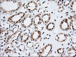 ERIC-1 / TACC3 Antibody - Immunohistochemical staining of paraffin-embedded Human Kidney tissue using anti-TACC3 mouse monoclonal antibody. (Dilution 1:50).