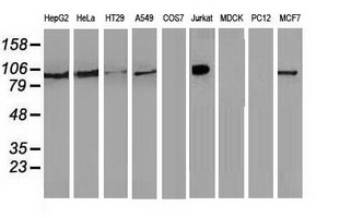 ERIC-1 / TACC3 Antibody - Western blot of extracts (35 ug) from 9 different cell lines by using anti-TACC3 monoclonal antibody.