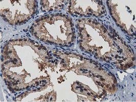 ERIC-1 / TACC3 Antibody - IHC of paraffin-embedded Human prostate tissue using anti-TACC3 mouse monoclonal antibody.