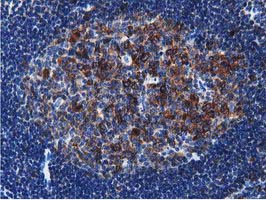 ERIC-1 / TACC3 Antibody - IHC of paraffin-embedded Human lymph node tissue using anti-TACC3 mouse monoclonal antibody.