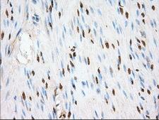 ERIC-1 / TACC3 Antibody - IHC of paraffin-embedded colon tissue using anti-TACC3 mouse monoclonal antibody. (Dilution 1:50).