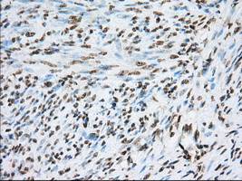 ERIC-1 / TACC3 Antibody - IHC of paraffin-embedded endometrium tissue using anti-TACC3 mouse monoclonal antibody. (Dilution 1:50).