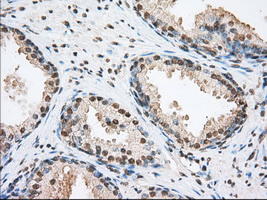 ERIC-1 / TACC3 Antibody - IHC of paraffin-embedded prostate tissue using anti-TACC3 mouse monoclonal antibody. (Dilution 1:50).