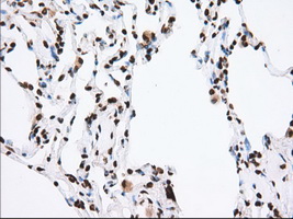 ERIC-1 / TACC3 Antibody - IHC of paraffin-embedded Human lung tissue using anti-TACC3 mouse monoclonal antibody. (Dilution 1:50).