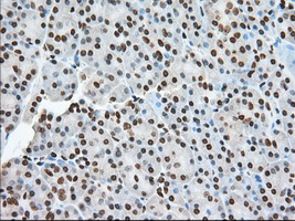 ERIC-1 / TACC3 Antibody - IHC of paraffin-embedded Human pancreas tissue using anti-TACC3 mouse monoclonal antibody. (Dilution 1:50).