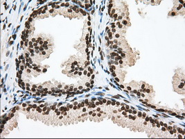 ERIC-1 / TACC3 Antibody - IHC of paraffin-embedded Human prostate tissue using anti-TACC3 mouse monoclonal antibody. (Dilution 1:50).